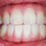 teeth-887338_1920