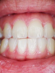 teeth-887338_1920